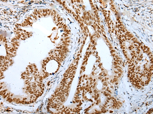 DEK Antibody