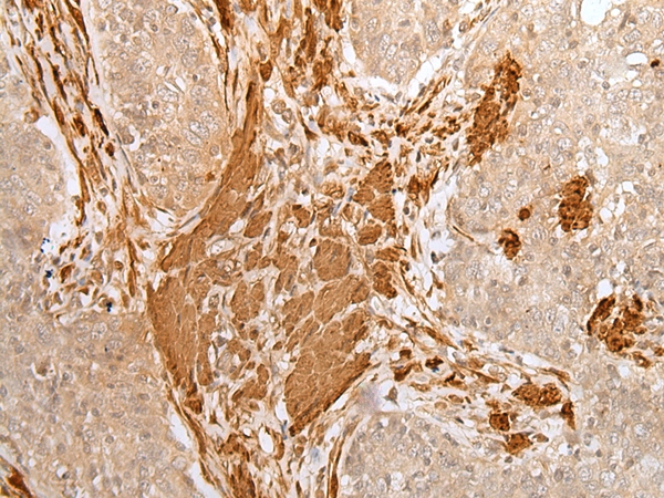 PF4 Antibody