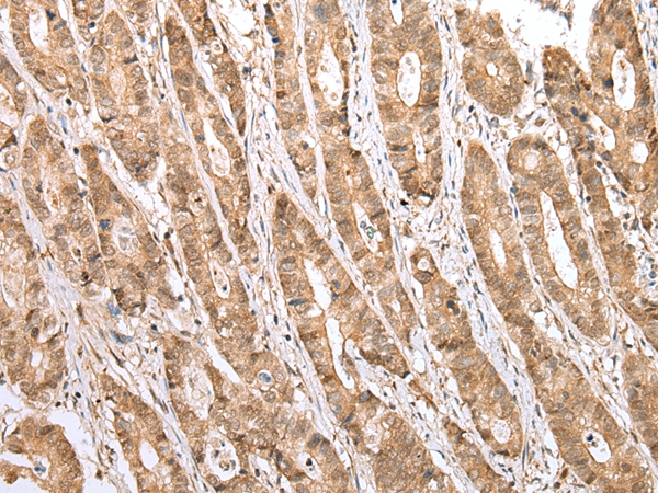 STAT3 Antibody