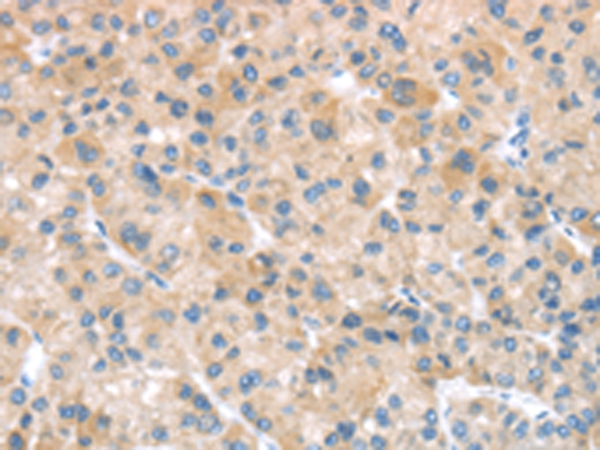 SFTPA1 Antibody