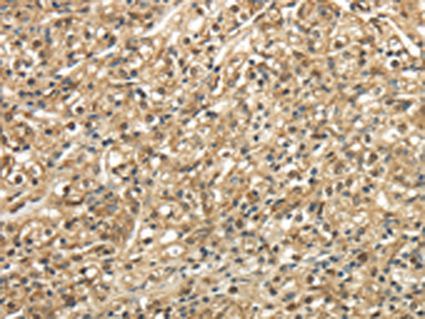 TSC22D1 Antibody