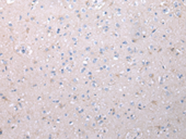 VCAN Antibody