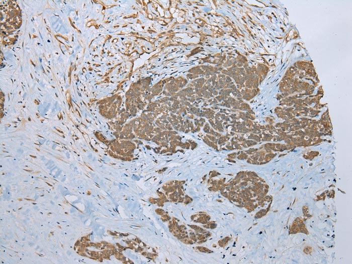 ZNF23 Antibody
