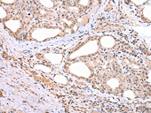 ARL17 Antibody