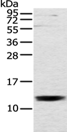 UQCRH Antibody