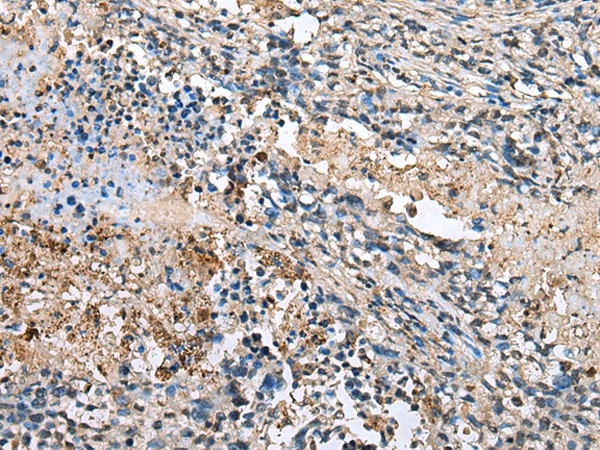 LMNTD1 Antibody