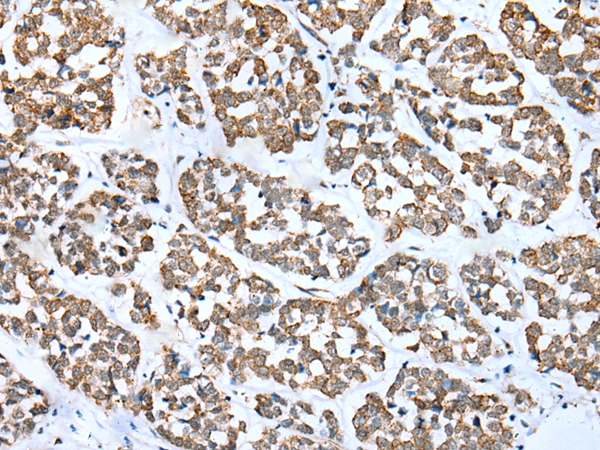 FSD1L Antibody