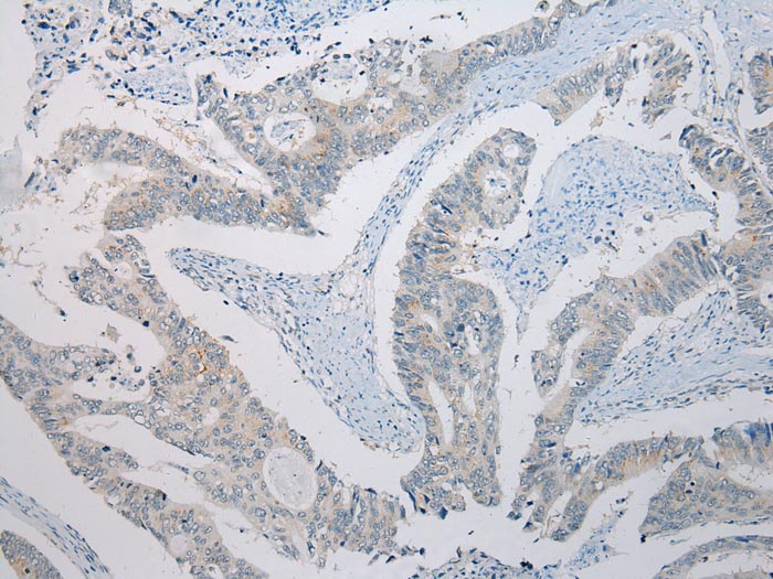 SLC35E2 Antibody