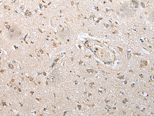 NUDT14 Antibody