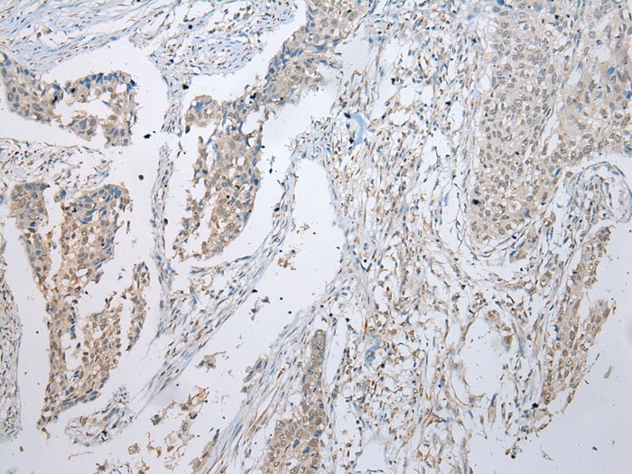 UBE2U Antibody
