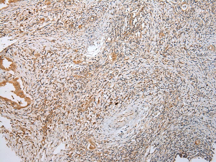 LYPLA2 Antibody