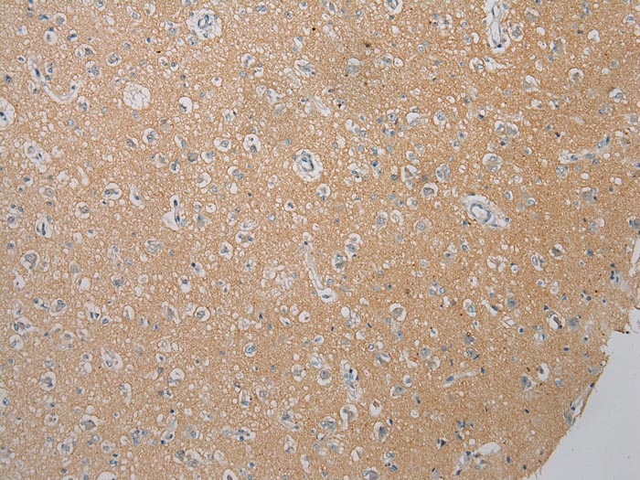 FOXN2 Antibody