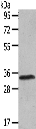 UCP3 Antibody