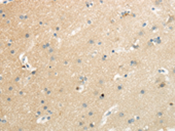 SLC7A11 Antibody