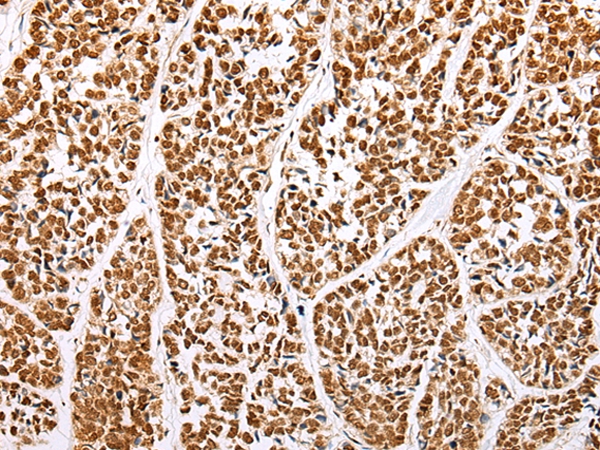 ABCA1 Antibody