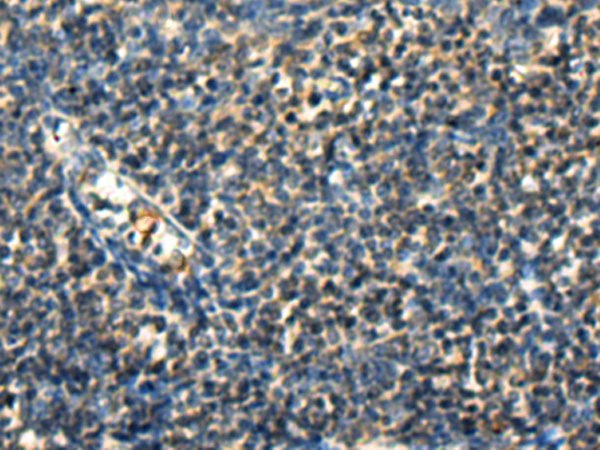 GLIPR2 antibody