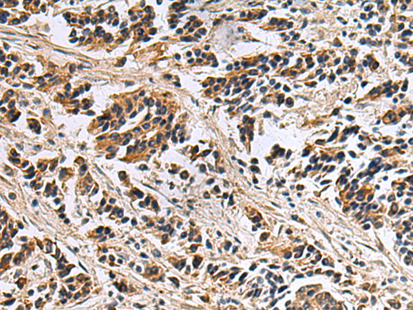 DIAPH2 antibody
