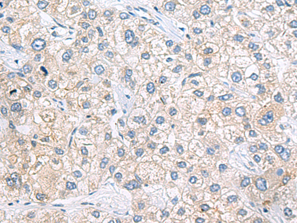 ZNF35 antibody