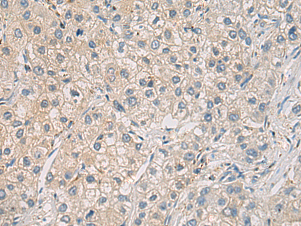 WFDC3 antibody