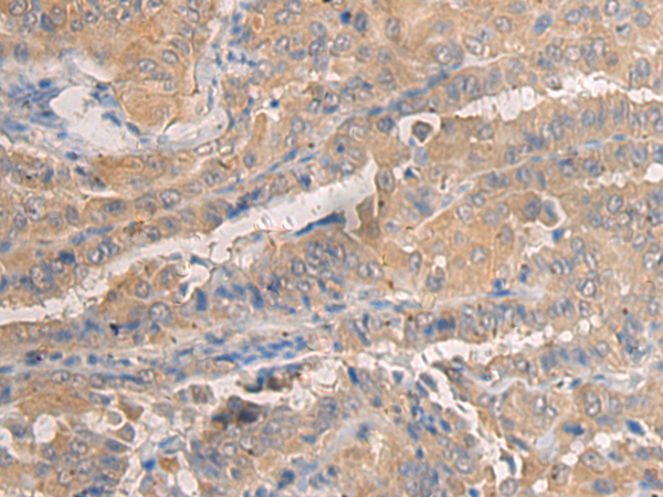 AGAP3 antibody