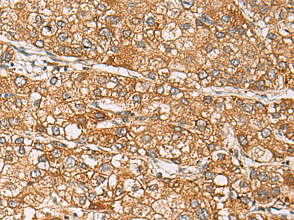 DCAF12 antibody