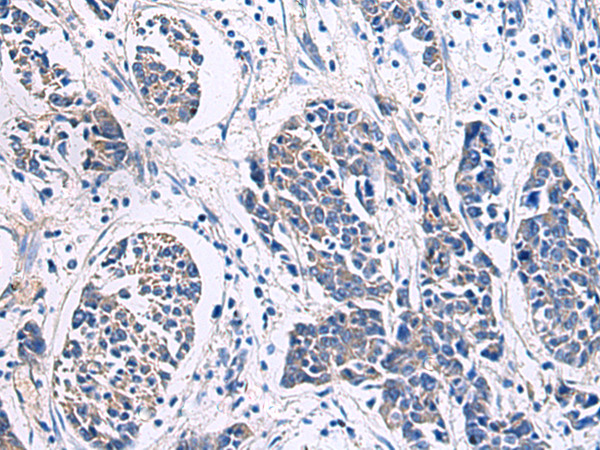 POLQ antibody
