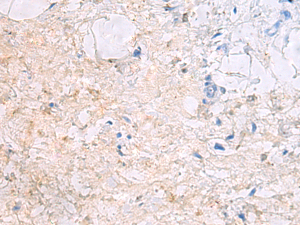 DPCD antibody