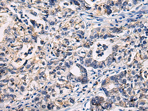 ADGRL4 antibody