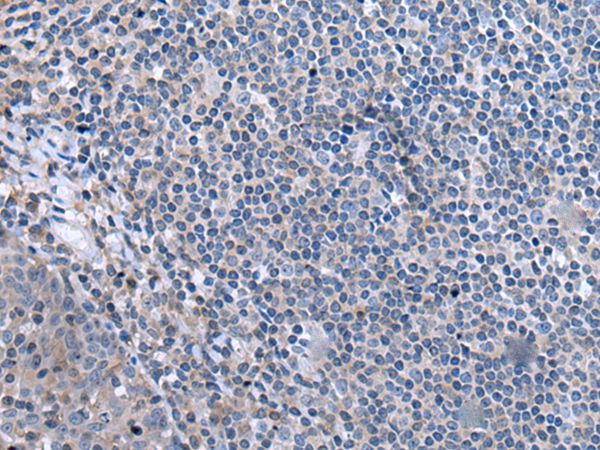 CCK Antibody