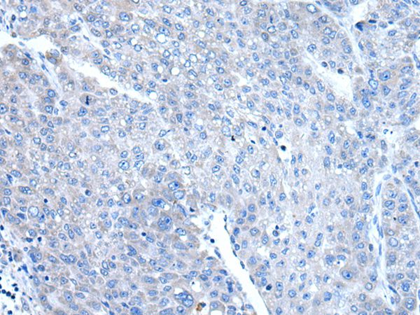 DAP Antibody
