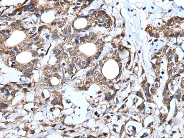 IRF4 Antibody