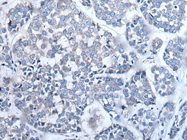 LCAT Antibody