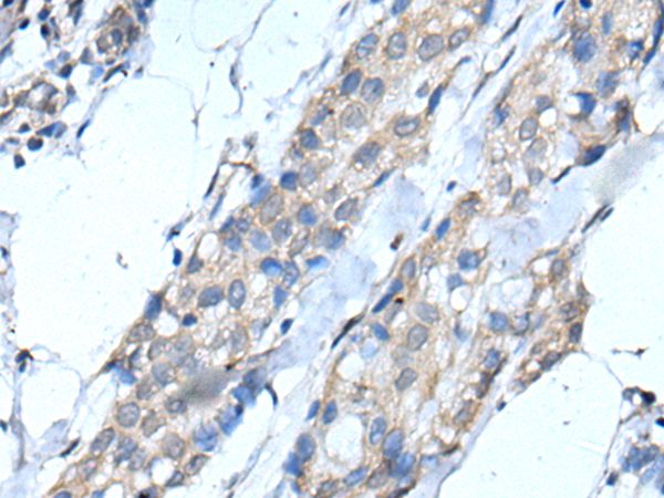 SCNN1G Antibody