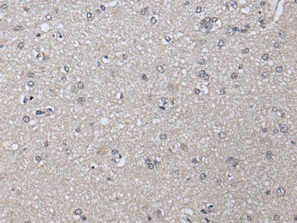 PRAME Antibody