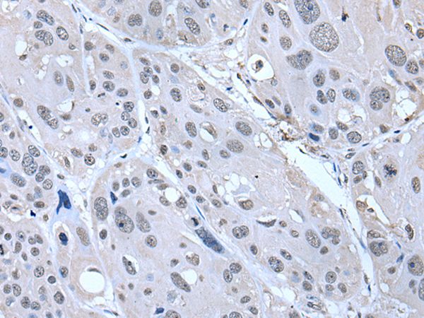 SERTAD1 Antibody