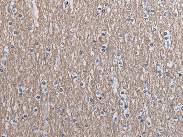 SLC39A14 Antibody