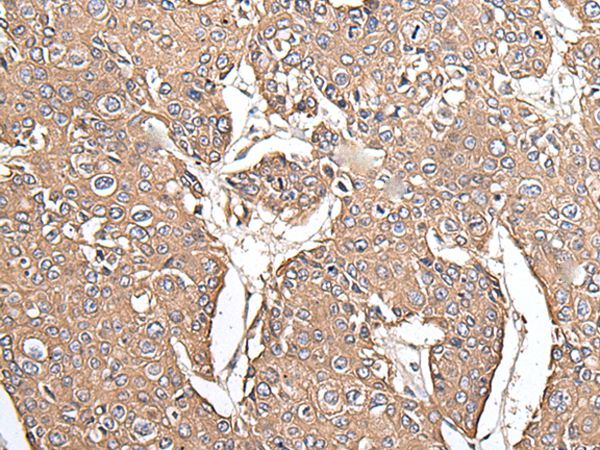 KRT73 Antibody