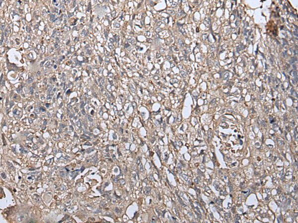 RUFY4 Antibody