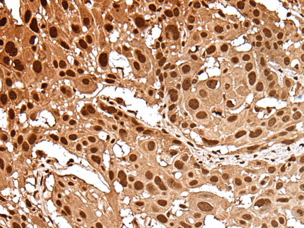 GAR1 Antibody