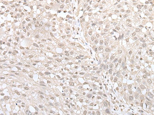 MIF4GD Antibody