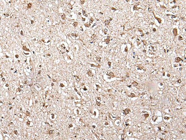 ZFP36 Antibody