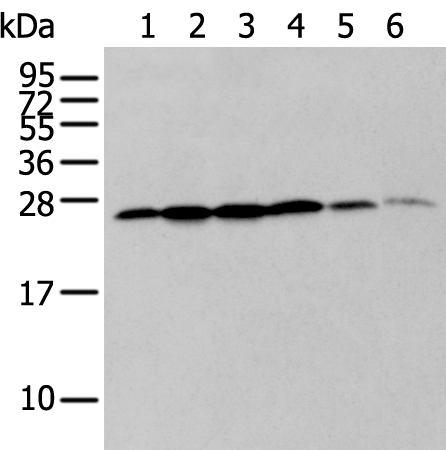 ZMAT2 Antibody