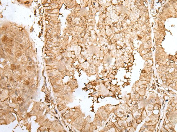 ZNF213 Antibody