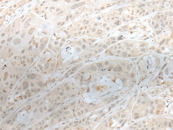 ZBTB18 Antibody