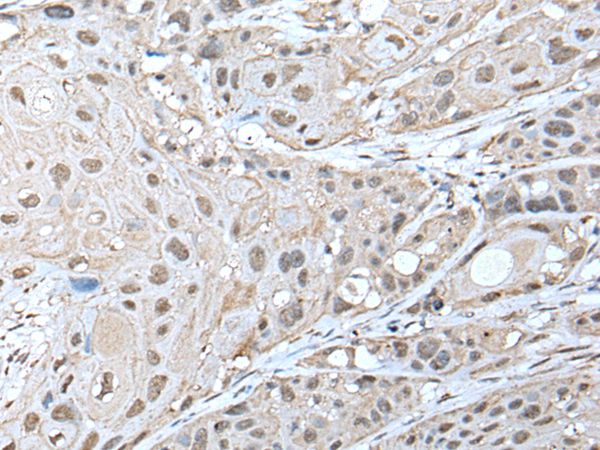 ZNF277 Antibody