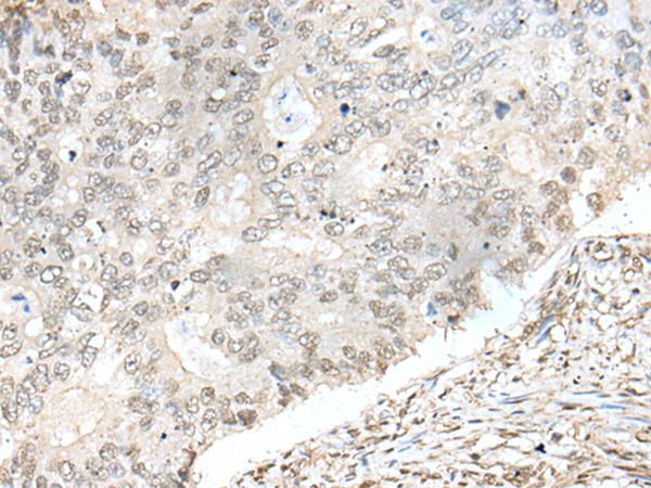 ZNF512 Antibody