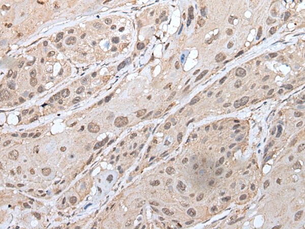 YPEL3 Antibody