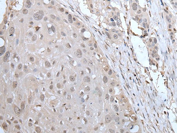 YPEL2 Antibody