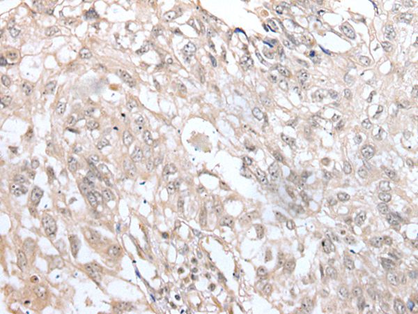 VRK3 Antibody