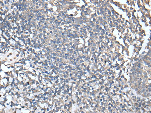 UBASH3A Antibody